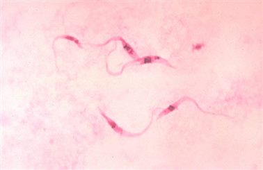 trypanosoma cruzi