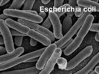 escherichia coli