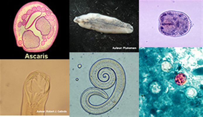 Parasites intestinaux (rando, trek, montagne)