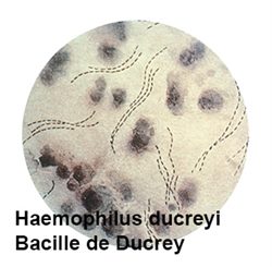 haemophilus ducreyi
