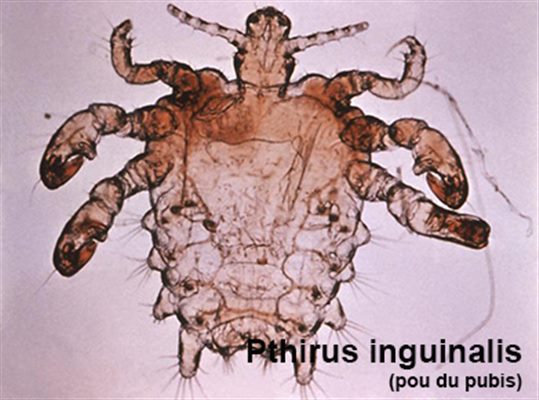 Morpions: pou du pubis : symptômes, traitement, définition ...