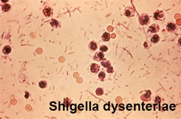 shigellose