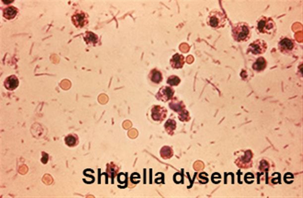 Shigelloses