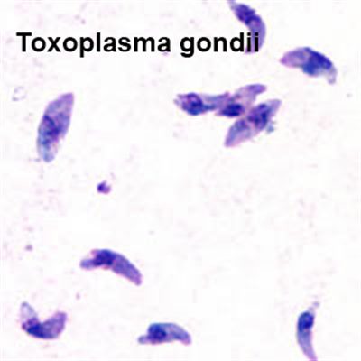 Toxoplasmose et MST