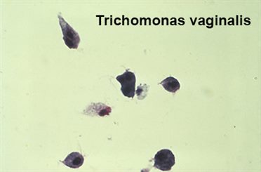 trichomonas vaginalis