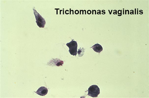 Trichomonase