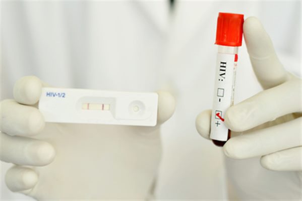 Tests de dépistage et de suivi du SIDA