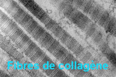 collagèene