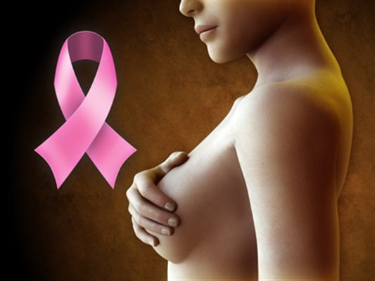 Reconstruction du sein après cancer