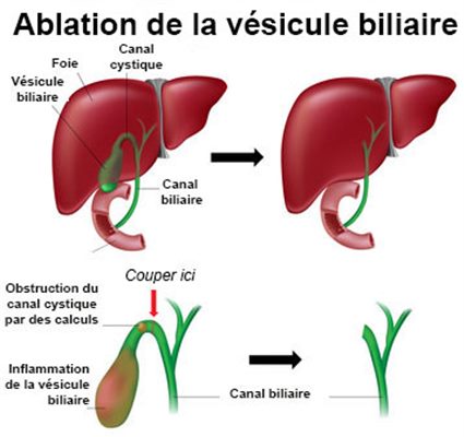 Ablations