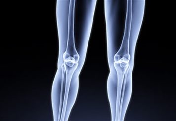 Ligaments du genou distendus - docteurclic.com