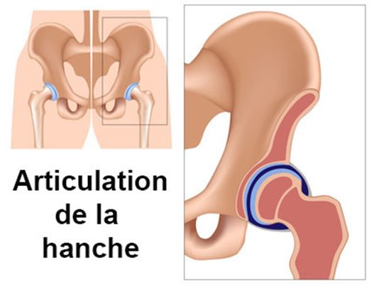 Rhume De Hanche Symptomes Traitement Definition Docteurclic Com