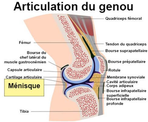 Rupture du ménisque : symptômes, traitement, définition ...