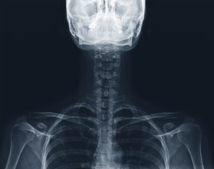 radiographie du rachis