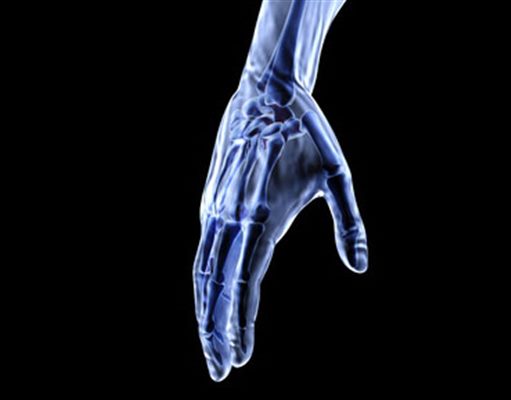 Fracture ou contusion de la main (rando, trek, montagne)
