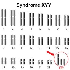 syndrome XYY