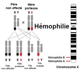 hémophilie