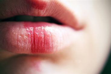 saignement de la bouche
