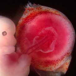 foetus et placenta
