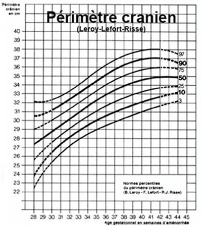 Retard de croissance intra-utérin