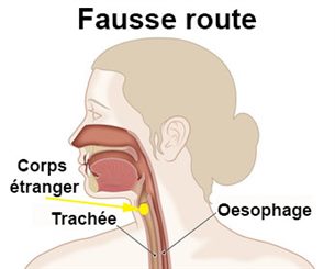 fauuse route