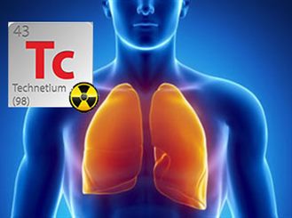 scintigraphie pulmonaire