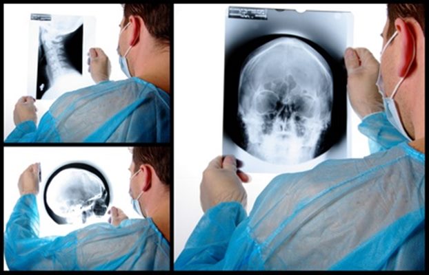 Radiographie du crâne