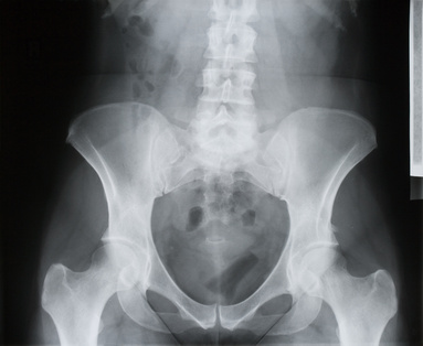 Radiographie Du Bassin Examen Docteurclic Com