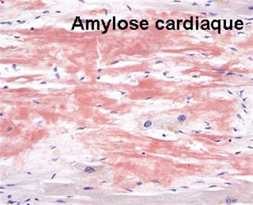 Amylose