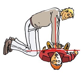 massage cardiaque