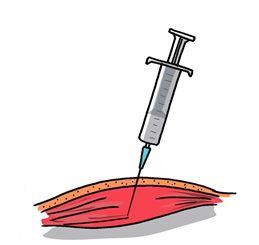 injection intramusculaire