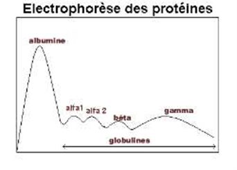 électrophorèse des protéines