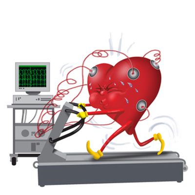 Électrocardiogramme d'effort