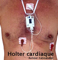 holter cardiaque