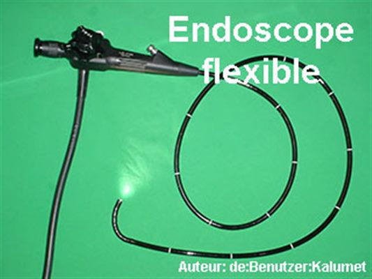 Endoscopie