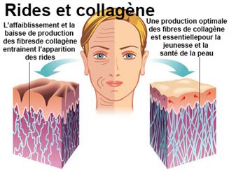 Vergetures : symptômes, traitement, définition 