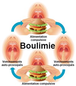 boulimie