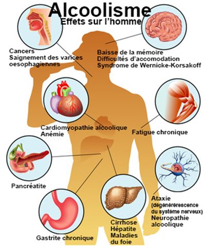 L'alcool et la consommation problématique