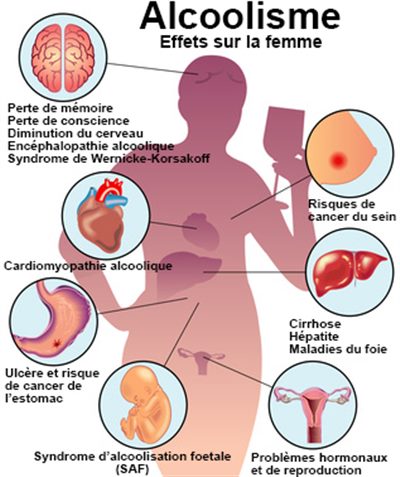 Alcoolisme : symptômes, traitement, définition - docteurclic.com