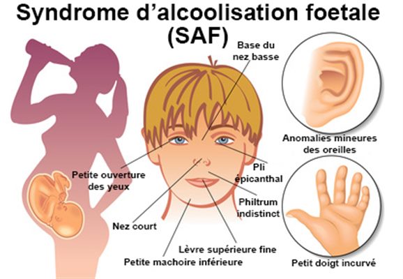 Tabac, alcool et drogues au cours de la grossesse