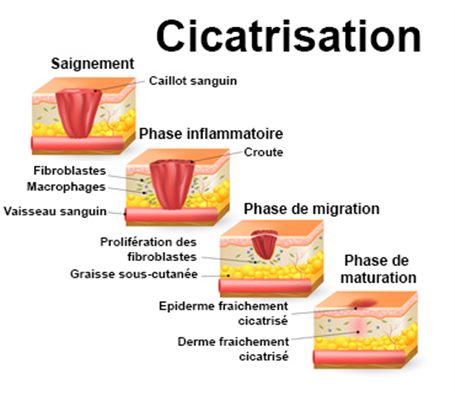 Cicatrisation