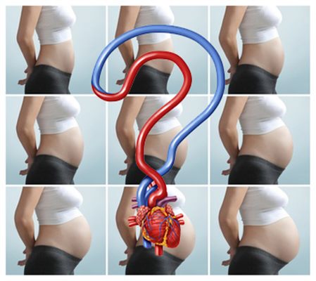 Grossesse et cardiopathies