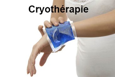 cryothérapie