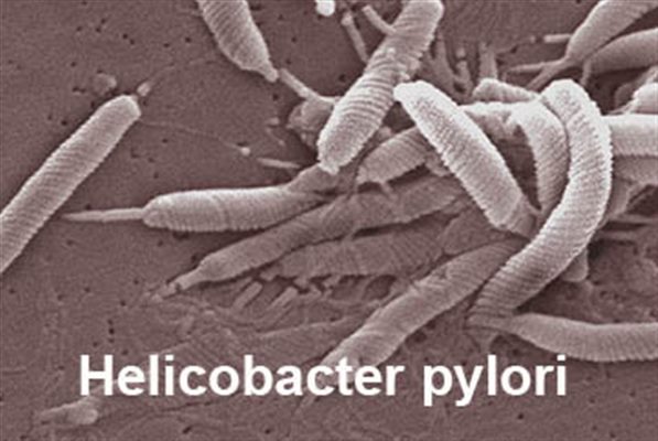 Hélicobacter pylori