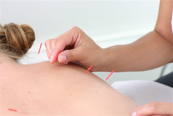Acupuncture : des réponses à vos questions