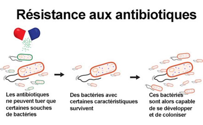 Antibiotiques et infections urinaires